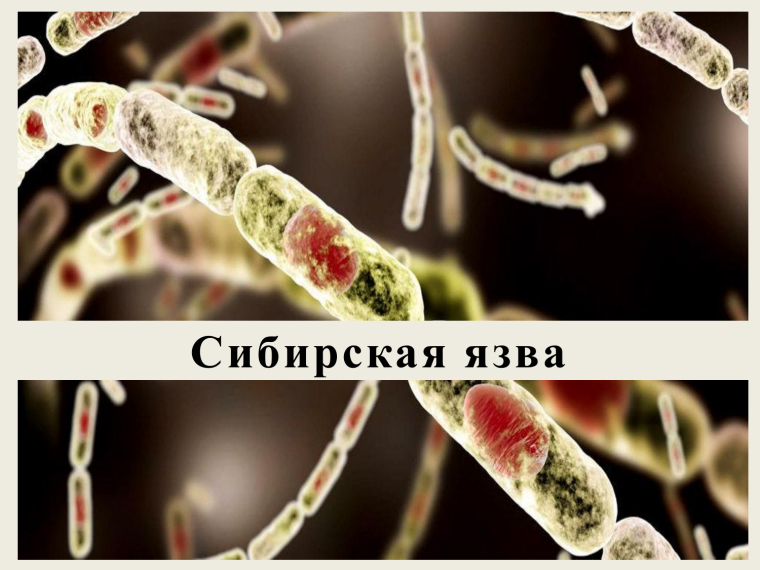 Сибирская язва: памятка для животноводов. Сибирская язва: памятка для животноводов.